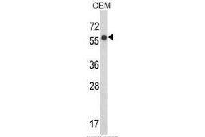 Western blot analysis of WDR1 Antibody (C-term) in CEM cell line lysates (35ug/lane). (WDR1 抗体  (C-Term))