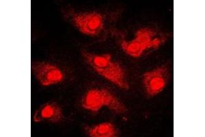 Immunofluorescent analysis of FOXO1 staining in MCF7 cells. (FOXO1 抗体  (Center))