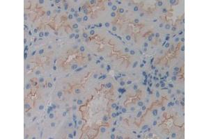Used in DAB staining on fromalin fixed paraffin- embedded kidney tissue (CHRNA3 抗体  (AA 32-240))