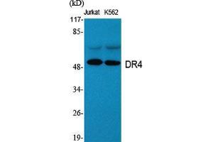 Western Blot (WB) analysis of specific cells using DR4 Polyclonal Antibody. (DR4 抗体  (C-Term))
