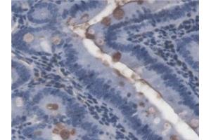 Detection of LPS in Rat Small intestine Tissue using Monoclonal Antibody to Lipopolysaccharide (LPS) (Lipopolysaccharides (LPS) 抗体)