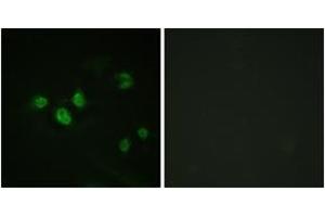 Immunofluorescence analysis of HeLa cells, using SP1 (Phospho-Thr453) Antibody.