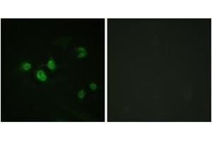 Immunofluorescence analysis of HeLa cells, using SP1 (Phospho-Thr453) Antibody. (SP1 抗体  (pThr453))