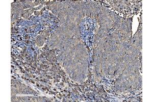 IHC analysis of P4HB using anti-P4HB antibody (ABIN7600075). (P4HB 抗体  (AA 146-363))