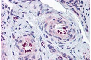 Human Uterus, Vessels (formalin-fixed, paraffin-embedded) stained with IL33 antibody ABIN343919 at 5 ug/ml followed by biotinylated goat anti-rabbit IgG secondary antibody ABIN481713, alkaline phosphatase-streptavidin and chromogen. (IL-33 抗体  (Internal Region))