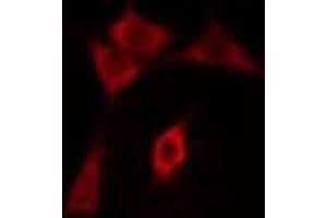 ABIN6275498 staining COLO205 cells by IF/ICC.