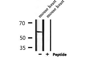 Western blot analysis of extracts from mouse heart, using PCTK2 Antibody.