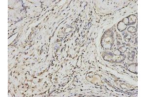 Immunohistochemistry (IHC) image for anti-Proteasome (Prosome, Macropain) Activator Subunit 1 (PA28 Alpha) (PSME1) antibody (ABIN1876546) (PSME1 抗体)