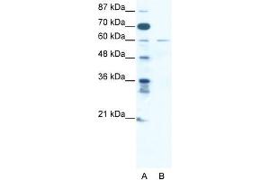 Human Jurkat; WB Suggested Anti-ZNF92 Antibody Titration: 2. (ZNF92 抗体  (C-Term, Isoform 2))