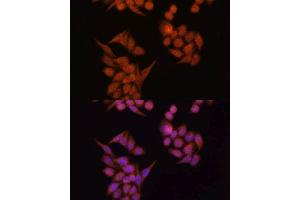 Immunofluorescence analysis of HeLa cells using OCLN antibody. (Occludin 抗体  (AA 263-522))