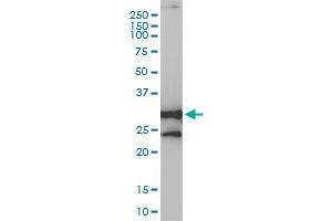 NQO1 monoclonal antibody (M01), clone 1E3-A6 Western Blot analysis of NQO1 expression in HepG2 .