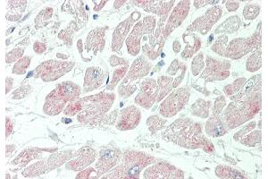Immunohistochemistry (IHC) image for anti-Kv Channel Interacting Protein 2 (KCNIP2) (N-Term) antibody (ABIN2776321)