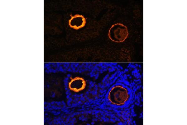 Zona Pellucida Glycoprotein 3 抗体  (AA 250-350)