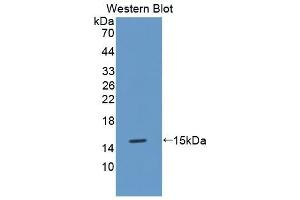 Detection of Recombinant MT3, Mouse using Polyclonal Antibody to Metallothionein 3 (MT3) (MT3 抗体  (AA 1-68))
