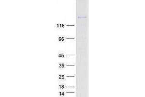 Western Blotting (WB) image for Complement Component 3 (C3) protein (Myc-DYKDDDDK Tag) (ABIN2712453)