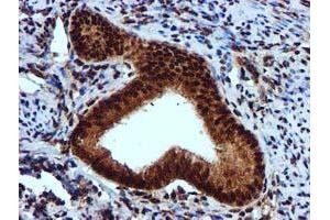 Image no. 9 for anti-EPM2A (Laforin) Interacting Protein 1 (EPM2AIP1) antibody (ABIN1498045) (EPM2AIP1 抗体)