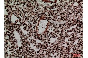 Immunohistochemistry (IHC) analysis of paraffin-embedded Mouse Lung, antibody was diluted at 1:100. (FOXP1 抗体  (C-Term))