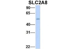 Host:  Rabbit  Target Name:  SLC2A8  Sample Type:  Human Fetal Heart  Antibody Dilution:  1. (SLC2A8 抗体  (Middle Region))