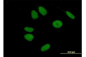 Immunofluorescence of purified MaxPab antibody to ZNF43 on HeLa cell. (ZNF43 抗体  (AA 1-803))