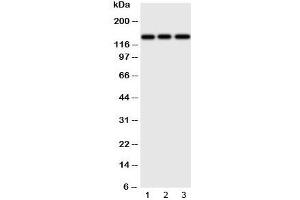 Western blot testing of ERBB4 antibody and Lane 1:  human HeLa;  2: (h) U87;  3: mouse Neuro-2a cell lysate. (ERBB4 抗体  (N-Term))