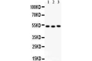 Anti- Factor VII antibody, Western blotting All lanes: Anti Factor VII  at 0. (Factor VII 抗体  (C-Term))