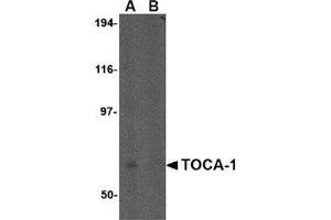 Western blot analysis of TOCA-1 in human brain tissue lysate in (A) the absence and (B) the presence of blocking peptide with this product at 0.