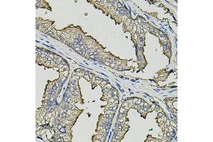 Immunohistochemistry of paraffin-embedded human prostate using SMN2 antibody (ABIN5974442) (40x lens). (SMN2 抗体)