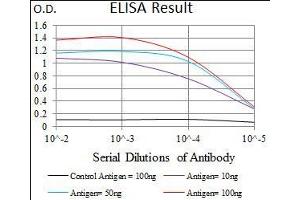 Black line: Control Antigen (100 ng), Purple line: Antigen(10 ng), Blue line: Antigen (50 ng), Red line: Antigen (100 ng), (DNAL4 抗体  (AA 1-105))