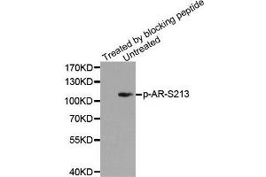 Western blot analysis of extracts from DU145 cells using Phospho-AR-S213 antibody. (Androgen Receptor 抗体  (pSer213))