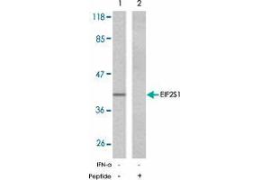 Western blot analysis of extracts from A-431 cells, untreated or EGF-treated (200 ng/ml, 5 min), using EIF2S1 polyclonal antibody  .