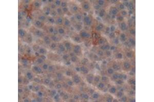 IHC-P analysis of Rat Tissue, with DAB staining. (SULT1A1 抗体  (AA 3-291))