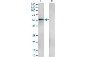 Western Blot analysis of ZNF207 expression in transfected 293T cell line by ZNF207 monoclonal antibody (M05), clone 7G1. (ZNF207 抗体  (AA 1-110))