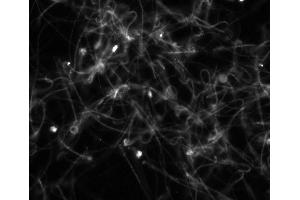 Mouse sperm immunofluorescence staining.