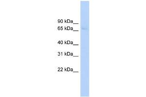 Western Blotting (WB) image for anti-ATP-Binding Cassette, Sub-Family F (GCN20), Member 2 (ABCF2) (Middle Region) antibody (ABIN2781515)