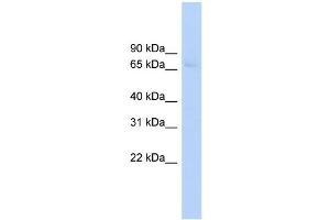 WB Suggested Anti-ABCF2 Antibody Titration:  0. (ABCF2 抗体  (Middle Region))