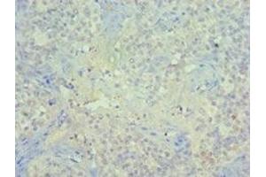 Immunohistochemistry of paraffin-embedded human tonsil tissue using ABIN7150963 at dilution of 1:100 (PIAS1 抗体  (AA 422-651))