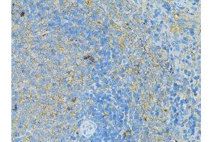 Immunohistochemistry of paraffin-embedded rat slpeen using TLR4 antibody (ABIN5975781) at dilution of 1/100 (40x lens). (TLR4 抗体)