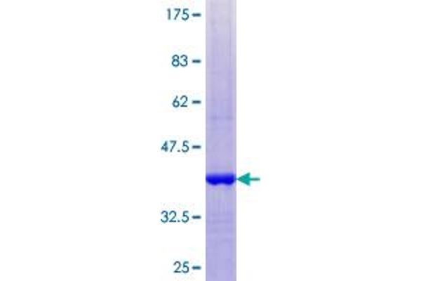 GUCA2A Protein (AA 1-115) (GST tag)