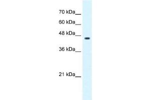GLIS3 antibody used at 0. (GLIS3 抗体  (C-Term))