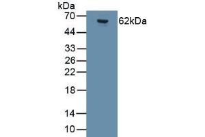 Detection of Recombinant GRIA2, Human using Monoclonal Antibody to Glutamate Receptor, Ionotropic, AMPA 2 (GRIA2) (GRIA2 抗体  (AA 413-527))