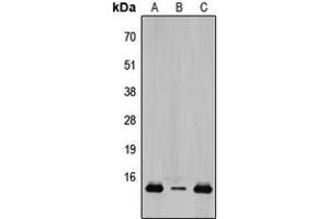 Western blot analysis of TCEAL8 expression in HeLa (A), Raw264. (TCEAL8 抗体  (Center))
