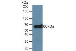 Detection of TRAF6 in Human A431 Cells using Polyclonal Antibody to TNF Receptor Associated Factor 6 (TRAF6) (TRAF6 抗体  (AA 153-423))