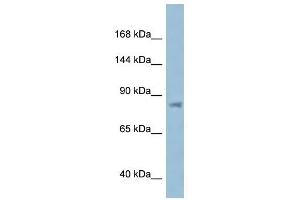 Western Blot showing KPNB1 antibody used at a concentration of 1 ug/ml against ACHN Cell Lysate (KPNB1 抗体  (N-Term))