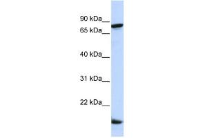 WB Suggested Anti-ZNF281 Antibody Titration:  0. (ZNF281 抗体  (Middle Region))