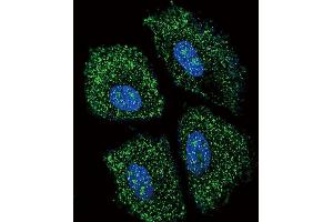 Confocal immunofluorescent analysis of UGT2B15 Antibody (Center) (ABIN656309 and ABIN2845611) with NCI- cell followed by Alexa Fluor 488-conjugated goat anti-rabbit lgG (green). (UGT2B15 抗体  (AA 156-185))
