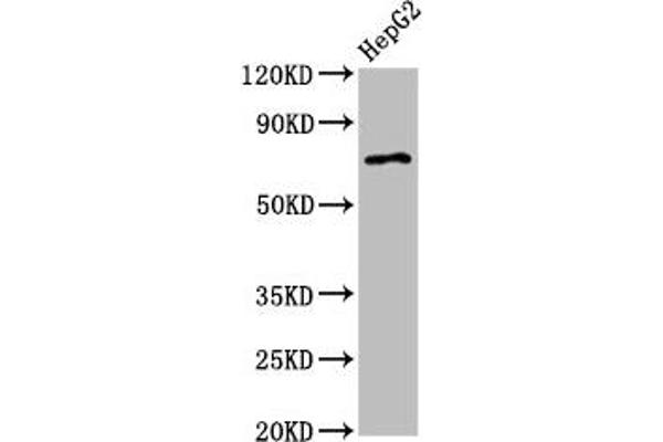 AGPS anticorps  (AA 279-400)