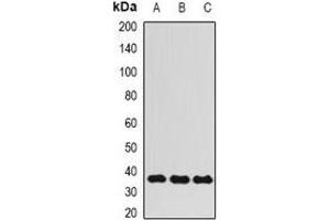 Western blot analysis of ALKBH3 expression in HepG2 (A), Hela (B), MCF7 (C) whole cell lysates. (ALKBH3 抗体)