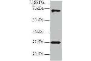Western blot All lanes: RPL17 antibody at 2 μg/mL + EC109 whole cell lysate Secondary Goat polyclonal to rabbit IgG at 1/15000 dilution Predicted band size: 22, 18, 27 kDa Observed band size: 27, 80 kDa (RPL17 抗体  (AA 2-184))