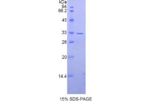 SDS-PAGE analysis of Human AXIN2 Protein. (AXIN2 蛋白)