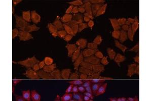 Immunofluorescence (IF) image for anti-Hydroxysteroid (17-Beta) Dehydrogenase 1 (HSD17B1) antibody (ABIN7255431)